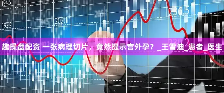 趣操盘配资 一张病理切片，竟然提示宫外孕？_王雪迪_患者_医生